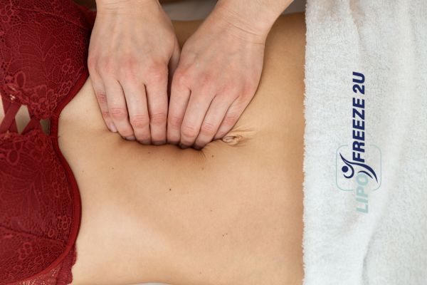 diastasis recti treatment West Yorkshire