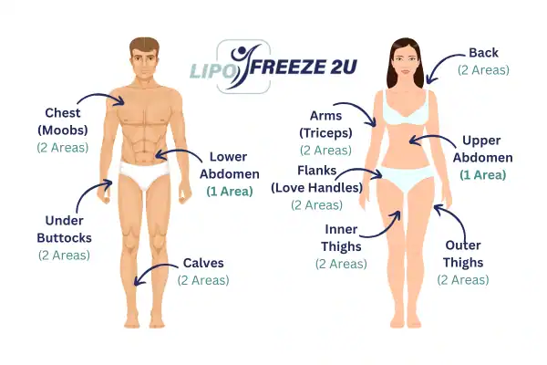 Areas you can have fat freezing treatment West Yorkshire