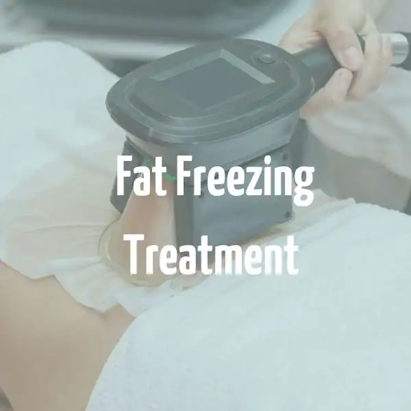 fat freezing treatment West Yorkshire
