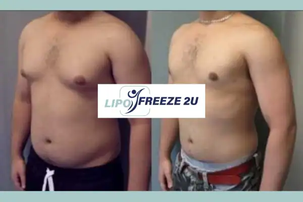 How Long Does It Take to See Results West Yorkshire?