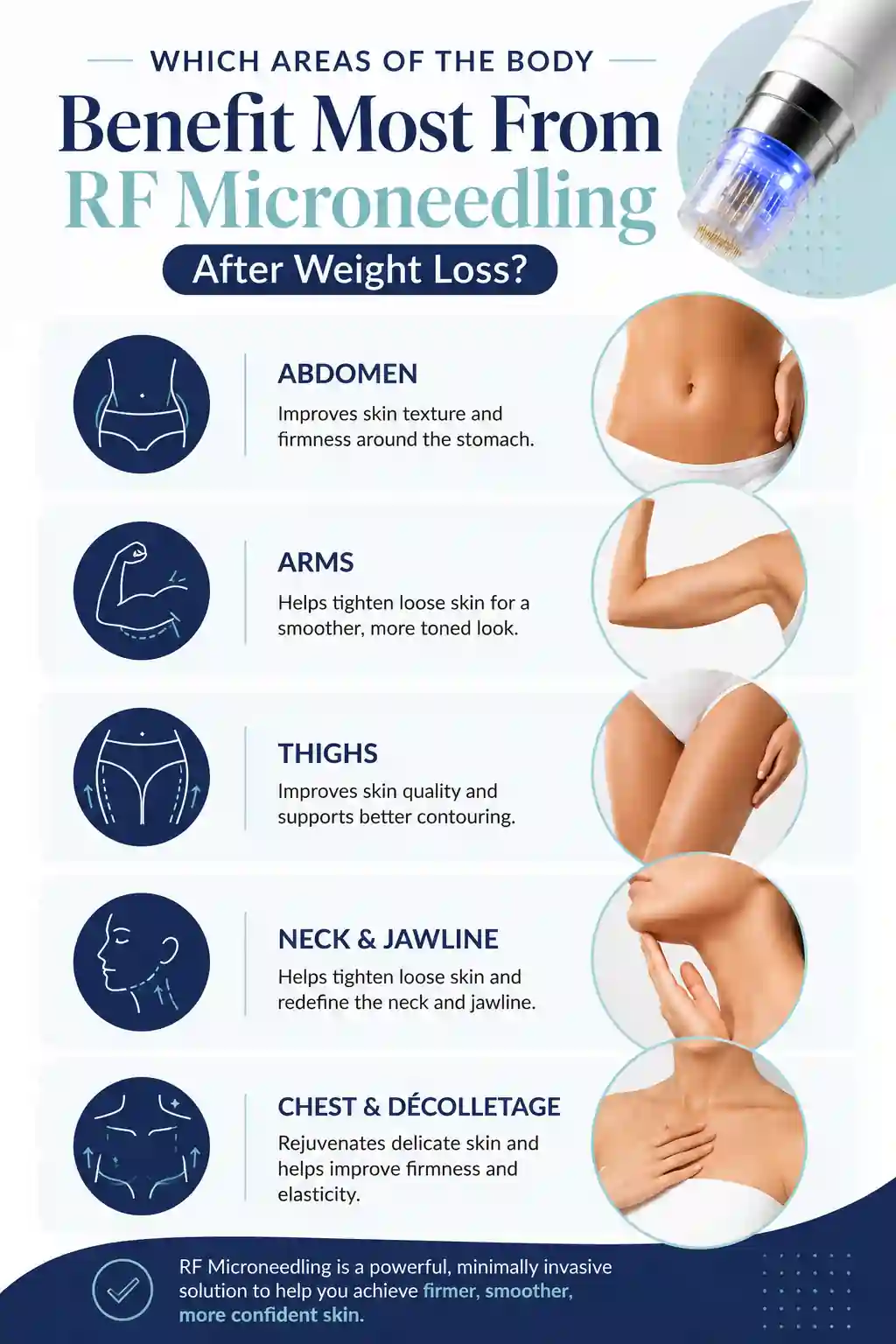 Which Areas of the Body Benefit Most From RF Microneedling After Weight Loss West Yorkshire
